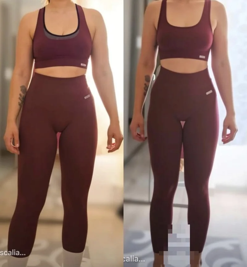 Antes e depois de paciente