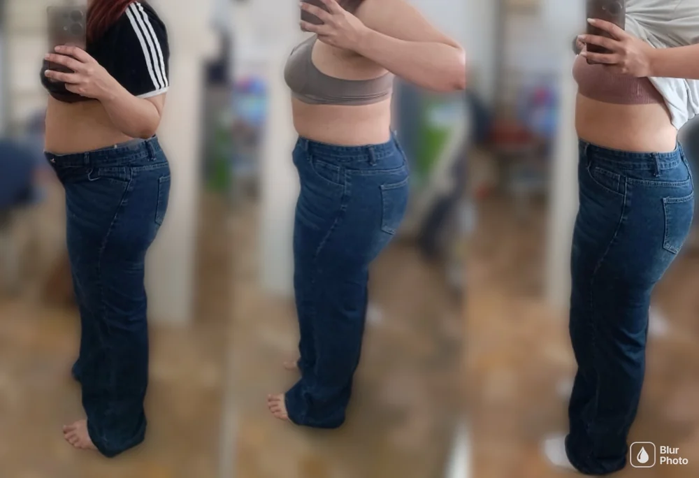 Antes e depois de paciente