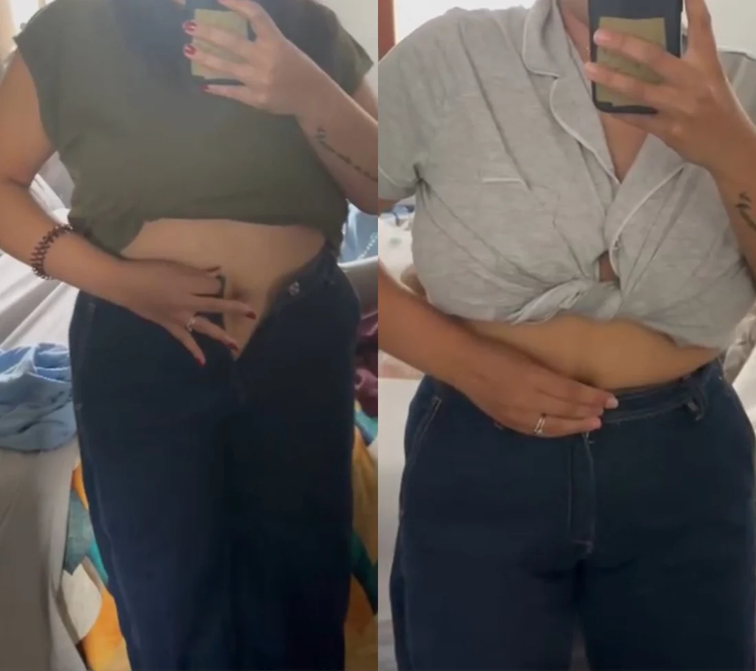 Antes e depois de paciente