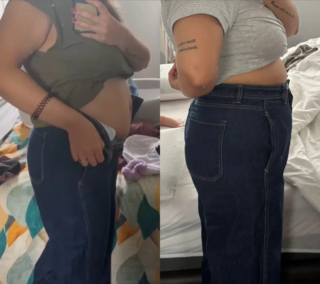Antes e depois de paciente